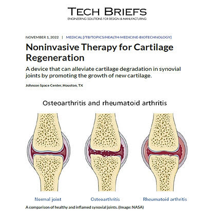 Noninvasive Therapy for Cartilage Regeneration.